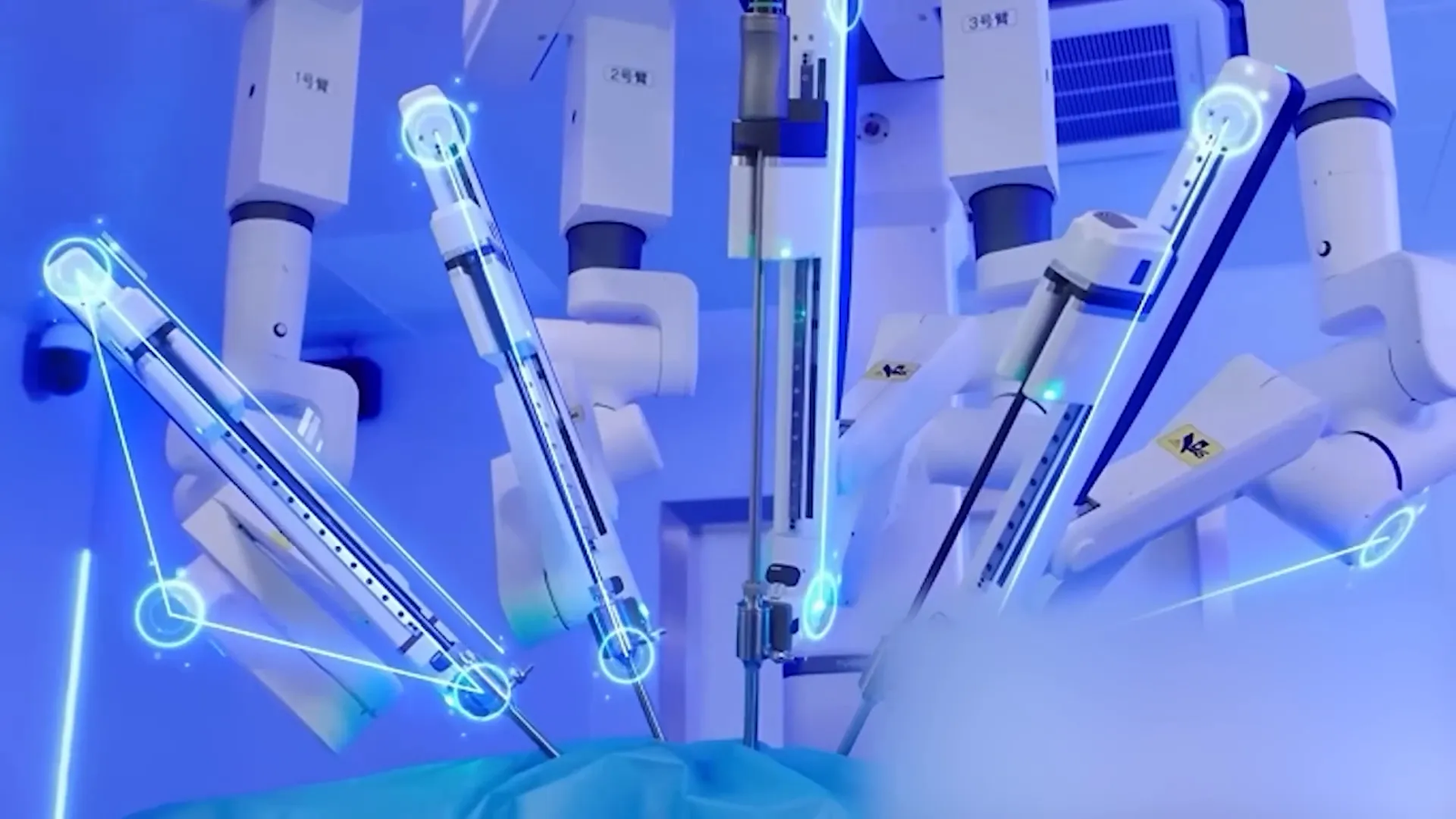 Robotic system for laparoscopic surgery